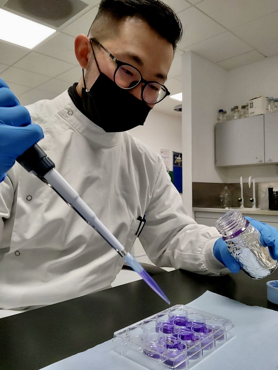 Fei-Fan (ESR 4) at University College Dublin during his secondment in Ireland doing crystal violet biofilm assay.